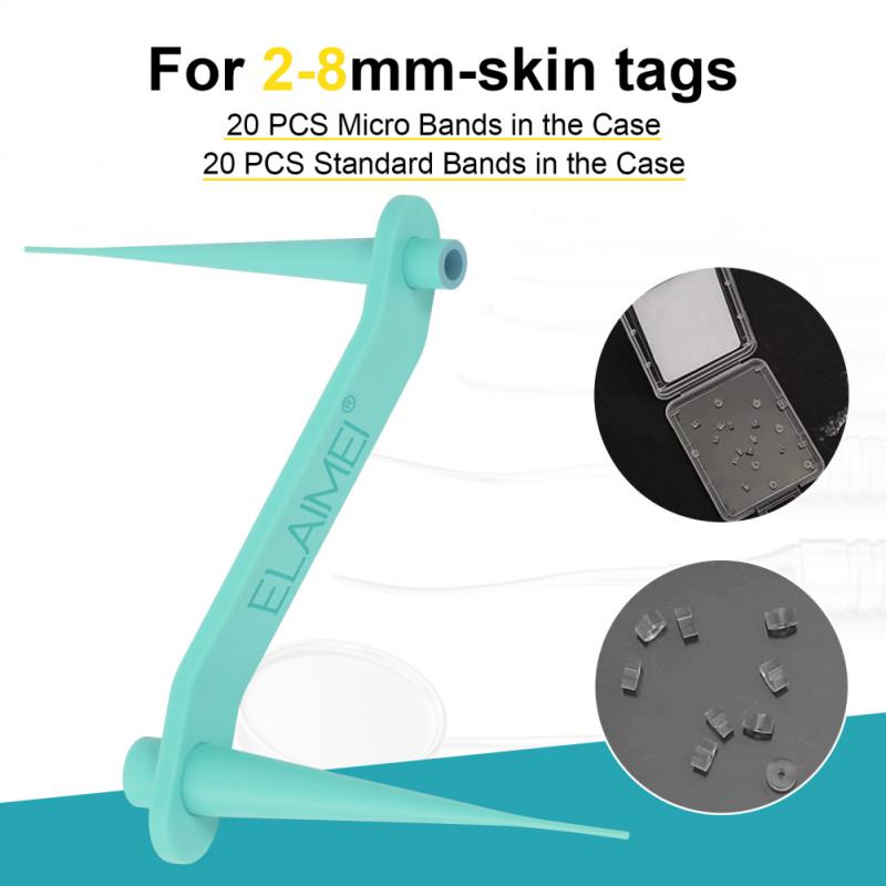 Skin Tag Remover Kit