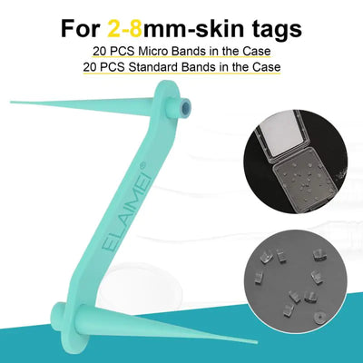 Skin Tag Removal Kit